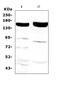Xanthine Dehydrogenase antibody, A01884, Boster Biological Technology, Western Blot image 
