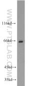 CBFA2/RUNX1 Partner Transcriptional Co-Repressor 3 antibody, 17190-1-AP, Proteintech Group, Western Blot image 