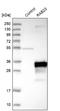 RAB23, Member RAS Oncogene Family antibody, NBP1-86366, Novus Biologicals, Western Blot image 