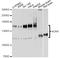 Adenosine Deaminase RNA Specific antibody, STJ110179, St John