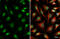 Von Hippel-Lindau Tumor Suppressor antibody, GTX101087, GeneTex, Immunocytochemistry image 
