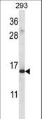 Ribosomal Protein S19 antibody, LS-C162735, Lifespan Biosciences, Western Blot image 