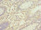 Sorbin And SH3 Domain Containing 3 antibody, A61106-100, Epigentek, Immunohistochemistry paraffin image 