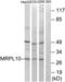 Mitochondrial Ribosomal Protein L10 antibody, LS-C119619, Lifespan Biosciences, Western Blot image 