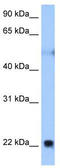 Reticulon 4 antibody, TA341875, Origene, Western Blot image 