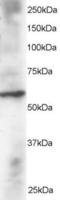 Dual Specificity Phosphatase 8 antibody, EB05318, Everest Biotech, Western Blot image 