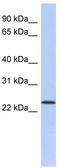 NKG2D ligand 1 antibody, TA339549, Origene, Western Blot image 