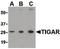 TP53 Induced Glycolysis Regulatory Phosphatase antibody, orb87298, Biorbyt, Western Blot image 