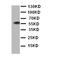 Bone Morphogenetic Protein Receptor Type 1A antibody, PA2016, Boster Biological Technology, Western Blot image 
