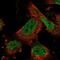 Zinc Finger Protein 484 antibody, NBP1-88750, Novus Biologicals, Immunocytochemistry image 