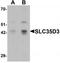 Solute Carrier Family 35 Member D3 antibody, TA320170, Origene, Western Blot image 