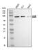 A-Kinase Anchoring Protein 8 antibody, A05133-2, Boster Biological Technology, Western Blot image 