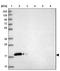 Calmodulin-like protein 3 antibody, NBP2-33434, Novus Biologicals, Western Blot image 