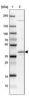 Stearoyl-CoA Desaturase 5 antibody, PA5-59963, Invitrogen Antibodies, Western Blot image 