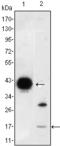 Fatty acid-binding protein, intestinal antibody, STJ98154, St John