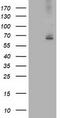IlvB Acetolactate Synthase Like antibody, TA503128S, Origene, Western Blot image 