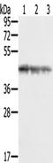 SWI/SNF-related matrix-associated actin-dependent regulator of chromatin subfamily B member 1 antibody, TA350434, Origene, Western Blot image 