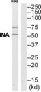 Internexin Neuronal Intermediate Filament Protein Alpha antibody, abx015205, Abbexa, Western Blot image 
