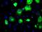 Proprotein Convertase Subtilisin/Kexin Type 7 antibody, NBP2-02106, Novus Biologicals, Immunocytochemistry image 