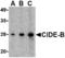 Cell Death Inducing DFFA Like Effector B antibody, A07404-1, Boster Biological Technology, Western Blot image 