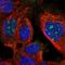 Zinc Finger Protein 324B antibody, HPA023400, Atlas Antibodies, Immunofluorescence image 