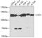 USO1 Vesicle Transport Factor antibody, A2796, ABclonal Technology, Western Blot image 