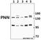 Pinin, Desmosome Associated Protein antibody, A01590-1, Boster Biological Technology, Western Blot image 