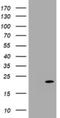 Cyclin Dependent Kinase Inhibitor 2C antibody, NBP2-46229, Novus Biologicals, Western Blot image 