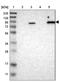 WNK Lysine Deficient Protein Kinase 2 antibody, NBP2-33875, Novus Biologicals, Western Blot image 