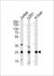 Glutathione S-Transferase Mu 1 antibody, 62-526, ProSci, Western Blot image 