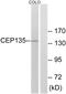 Centrosomal Protein 135 antibody, GTX87924, GeneTex, Western Blot image 