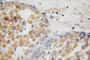 Epidermal Growth Factor Receptor Pathway Substrate 8 antibody, 12455-1-AP, Proteintech Group, Immunohistochemistry frozen image 