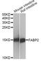 Fatty acid-binding protein, intestinal antibody, A1621, ABclonal Technology, Western Blot image 