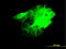 CDC42 Binding Protein Kinase Beta antibody, LS-C133593, Lifespan Biosciences, Immunofluorescence image 