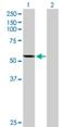 Cytochrome P450 Family 2 Subfamily A Member 7 antibody, H00001549-D01P, Novus Biologicals, Western Blot image 