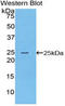 Filaggrin antibody, LS-C293943, Lifespan Biosciences, Western Blot image 