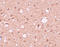 Amyloid Beta Precursor Protein Binding Family A Member 2 antibody, A06783-1, Boster Biological Technology, Immunohistochemistry paraffin image 