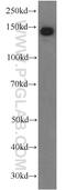 Ceruloplasmin antibody, 66156-1-Ig, Proteintech Group, Western Blot image 