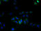 Leucine Rich Repeat Containing 8 VRAC Subunit E antibody, A59674-100, Epigentek, Immunofluorescence image 