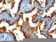 Mucin 1, Cell Surface Associated antibody, V2726IHC-7ML, NSJ Bioreagents, Immunohistochemistry paraffin image 
