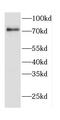 CD2 Associated Protein antibody, FNab01455, FineTest, Western Blot image 
