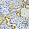 DNA Polymerase Gamma 2, Accessory Subunit antibody, 22-412, ProSci, Immunohistochemistry paraffin image 