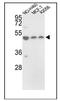 Protein Disulfide Isomerase Family A Member 6 antibody, AP17628PU-N, Origene, Western Blot image 