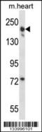 Capping Protein Regulator And Myosin 1 Linker 3 antibody, 57-418, ProSci, Western Blot image 