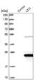 Leucine Zipper And CTNNBIP1 Domain Containing antibody, PA5-55790, Invitrogen Antibodies, Western Blot image 
