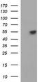 Tubulin Beta 1 Class VI antibody, TA506805, Origene, Western Blot image 