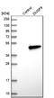 Dual Specificity Phosphatase 9 antibody, NBP1-82641, Novus Biologicals, Western Blot image 