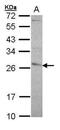 Glutathione S-transferase P 1 antibody, PA5-77994, Invitrogen Antibodies, Western Blot image 