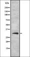 Pituitary homeobox 3 antibody, orb337558, Biorbyt, Western Blot image 