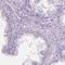 Protein Inhibitor Of Activated STAT 2 antibody, HPA068792, Atlas Antibodies, Immunohistochemistry frozen image 
